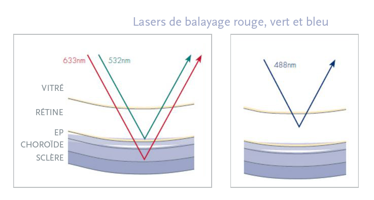 Coherent Laser Light